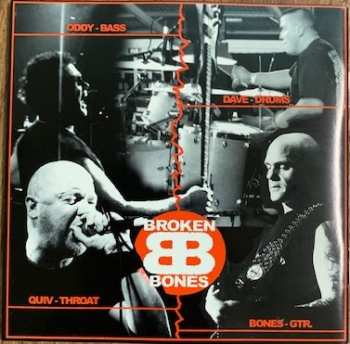 CD Broken Bones: Time For Anger,  Not Justice