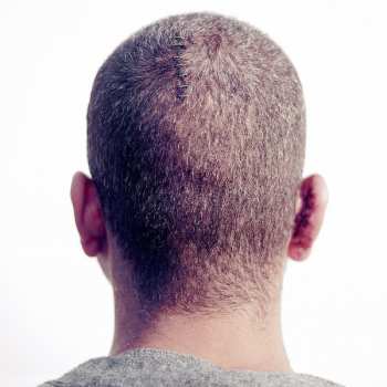 Album Electric)noise(Machine: PARDON