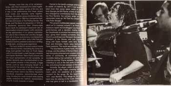 2CD Little Feat: Waiting For Columbus DLX