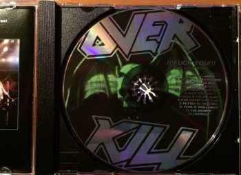 CD Overkill: Fuck You And Then Some