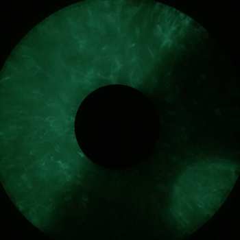 LP VOLA: Witness LTD | CLR